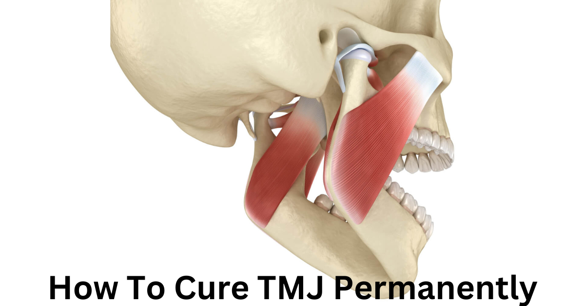 How To Cure TMJ Permanently